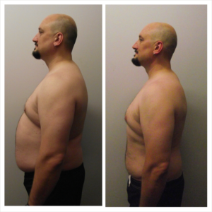 Greg Bellanger Before and After
